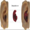 Doc's ProPlugs (Pair) Clear, Vented - Large view 3