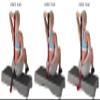 Elastiband 3 Strength Bulk view 3