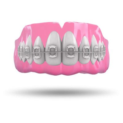 Impact Custom Professional MMA/Boxing/Muay Thai Mouthguard with Trim for Gag Reflex Braces