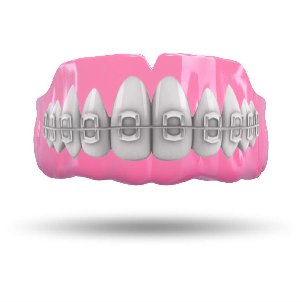 Impact Custom Professional MMA/Boxing/Muay Thai Mouthguard with Trim for Gag Reflex Braces