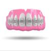 Impact Custom Professional MMA/Boxing/Muay Thai Mouthguard with Trim for Gag Reflex Braces view 1