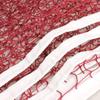 Toporchid Badminton Net Indoor Outdoor Sports Portable Quickstart Badminton Square Net(Red Wine) view 3