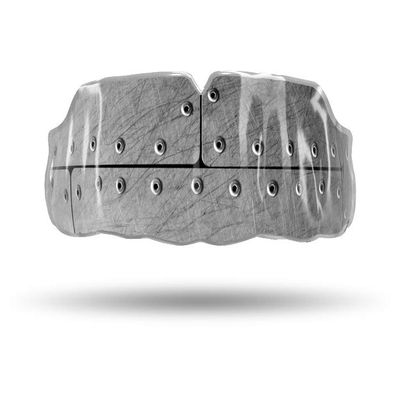Impact Custom Professional All Sports Mouthguard with Trim for Gag Reflex (Rivets & Steel)