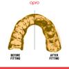 OPRO Instant Custom-Fit Mouth Guard, Dentist-Level Comfort, Protection & Fit - Moldable Mouthguard for Football, Boxing, Rugby, MMA, BJJ, UFC Mouth Piece- Includes Mouth Guard Case (USA, Adult) view 3