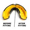 Legenda Mouth Guard Sports w/Case, Professional Mouthguard for Boxing, Football, Hockey, Jiu Jitsu, Muay Thai, MMA, Wrestling and High Contact Sports, Fits Adults, Youth, Kids 11+ (Black/Yellow) view 2