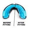 Legenda Mouth Guard Sports w/Case, Professional Mouthguard for Boxing, Football, Hockey, Jiu Jitsu, Muay Thai, MMA, Wrestling and High Contact Sports, Fits Adults, Youth, Kids 11+ (Black/Blue) view 2