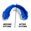Legenda Mouth Guard Sports w/Case, Professional Mouthguard for Boxing, Football, Hockey, Jiu Jitsu, Muay Thai, MMA, Wrestling and High Contact Sports, Fits Adults, Youth, Kids 11+ (White/Blue) view 2