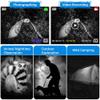 Digital Night Vision Monocular 5X HD Digital Zoom 656ft/200m Viewing Scope Portable Infrared Camera with 1.5" TFT Screen and 32GB TF Card Take HD Photos/Videos for Hunting Adventure Camping,Black view 4