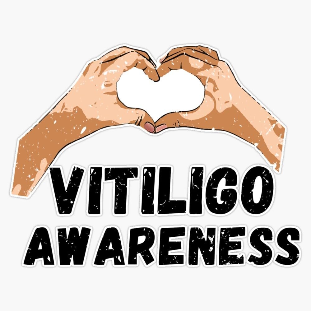 World Vitiligo Day Sticker Vinyl Decal Car Laptop Wall Window Bumper Sticker 5"