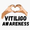 World Vitiligo Day Sticker Vinyl Decal Car Laptop Wall Window Bumper Sticker 5" view 1