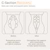KUB 2 in 1 postpartum back support belly band, c section recovery belly binder for pelvis, lumbar, waist pain relief, abdominal belly wrap, girdle for breastfeeding women, Large view 4