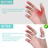 FEYRUN Baseball Thumb Guard Soft Silicone for Reduced Bat Sting, Swing Hitting Trainer Aid (White) view 2