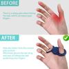 FEYRUN Baseball Thumb Guard Soft Silicone for Reduced Bat Sting, Swing Hitting Trainer Aid (Blue) view 2