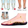 Liggici Avylays Orthopedic Flip-Flops, Breathable Mesh Hollow Sports Sandals, Wedge Sandals for Women (Grey, US:8/EU:40) view 4