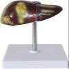 Gallbladder Anatomy Model, Human Liver Pathology Educational Model, Life Size Liver Disease Anatomical Model, Fatty Cirrhosis Carcinoma Hepatobiliary Disease Model, 2 Detachable Parts for Teaching. view 1