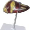 Gallbladder Anatomy Model, Human Liver Pathology Educational Model, Life Size Liver Disease Anatomical Model, Fatty Cirrhosis Carcinoma Hepatobiliary Disease Model, 2 Detachable Parts for Teaching. view 4
