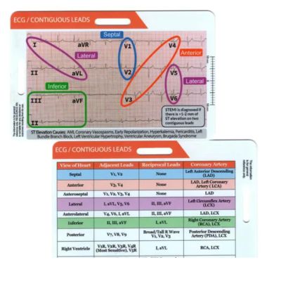 Funny ECG EKG Rhythm Pocket Card,Double Sided Badge Card EKG Telemetry Interpretation Badge Buddy Nursing Cheat Sheet with EKG Ruler Measurement (C)