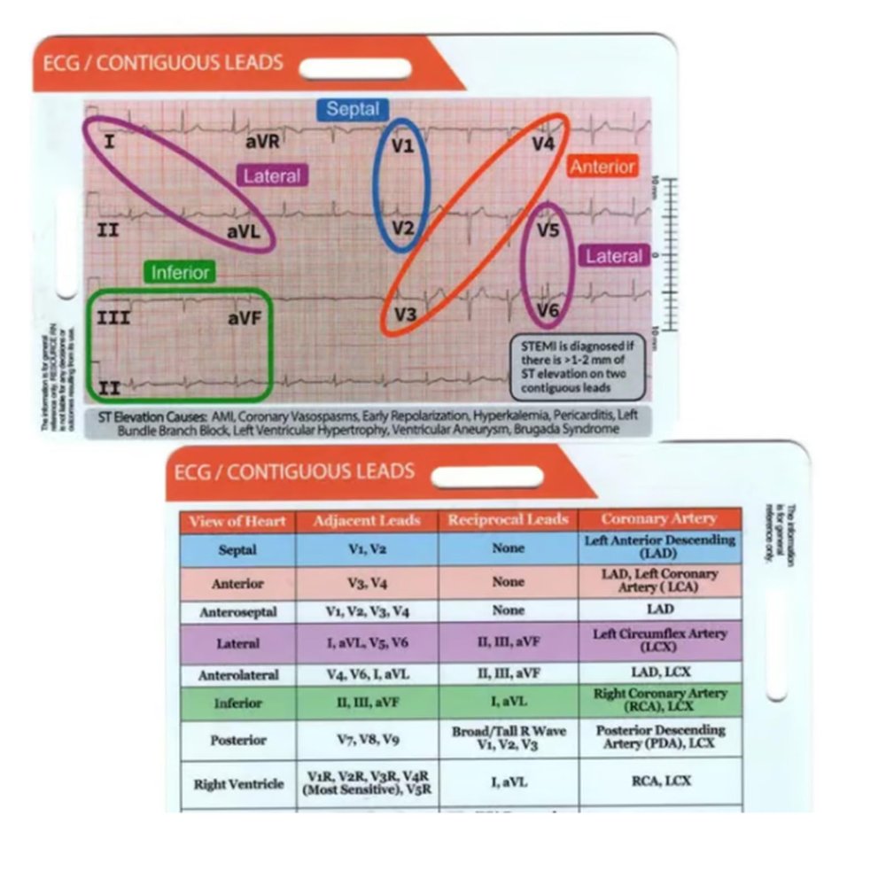 Funny ECG EKG Rhythm Pocket Card,Double Sided Badge Card EKG Telemetry Interpretation Badge Buddy Nursing Cheat Sheet with EKG Ruler Measurement (C)